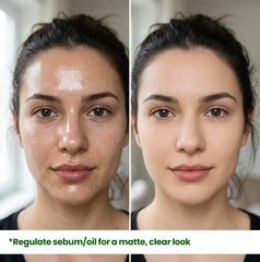 Comparison of oily, shiny skin before and after using HerbaNutrix Niacinamide and Zinc PCA serum, demonstrating immediate sebum regulation for a long-lasting matte and clear facial look.