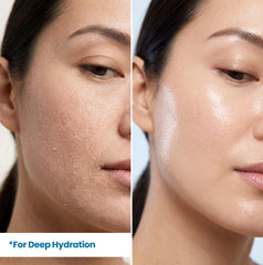 Before and after using HerbaNutrix Hyaluronic Supreme Hydration Serum showing transformation from severely dry, flaky skin to deeply hydrated, plump and dewy skin — 2% hyaluronic acid deep hydration treatment for dry skin