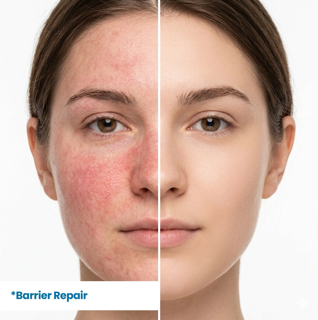 Before and after results of HerbaNutrix Hyaluronic Supreme Hydration Serum on redness-prone sensitive skin — skin barrier repair showing reduced redness, calmed irritation and restored even skin tone with Panthenol Vitamin B5 and Beta Glucan
