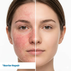 Before and after results of HerbaNutrix Hyaluronic Supreme Hydration Serum on redness-prone sensitive skin — skin barrier repair showing reduced redness, calmed irritation and restored even skin tone with Panthenol Vitamin B5 and Beta Glucan