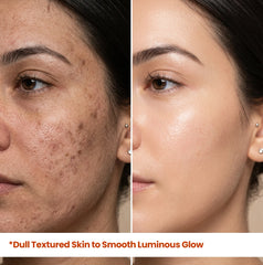 A compelling before-and-after split-face comparison of a woman's complexion. The left side shows visible uneven skin tone with dark spots and freckles. The right side demonstrates a transformation to an even, clear, and radiant complexion after using HerbaNutrix Vitamin C Ultra Glow Serum. Headline text: *Uneven Skin Tone to Even Radiant Complexion. Highlights efficacy in fading hyperpigmentation.