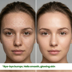 A before and after skin transformation using HerbaNutrix 12% Niacinamide serum, showing a visible reduction in small forehead bumps and the achievement of a smooth, healthy glowing complexion.