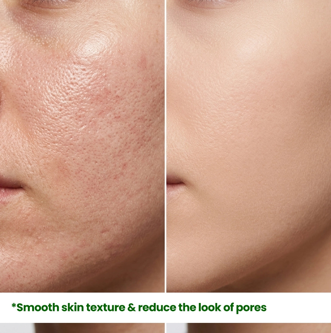 Macro close-up of skin pores before and after 4 weeks of HerbaNutrix Niacinamide Pro usage, showing significantly tighter pores and a refined, smooth skin surface texture.