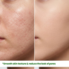 Macro close-up of skin pores before and after 4 weeks of HerbaNutrix Niacinamide Pro usage, showing significantly tighter pores and a refined, smooth skin surface texture.