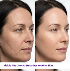 Real results comparison showing visible fine lines transformed into smoother, youthful-looking skin using HerbaNutrix Retinol Advanced Renewal treatment.